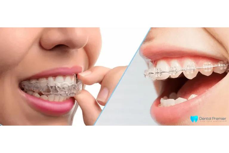 Te gândești la o schimbare dentară pentru 2026? Află totul aici despre aparatul invizibil Te gândești la o schimbare dentară pentru 2026? Află totul aici despre aparatul invizibil