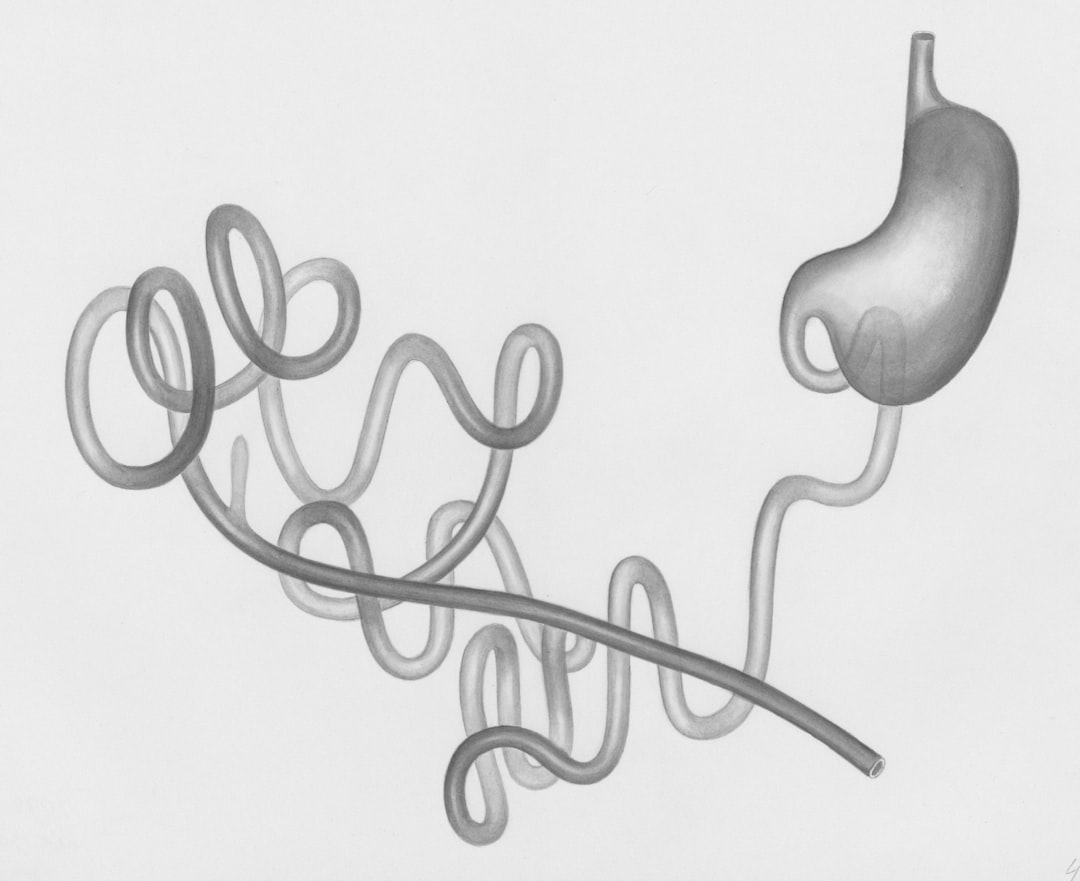 Photo digestion